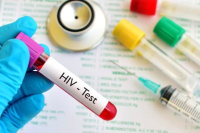 consulta HIV Leblon - infectologista - rio de janeiro - exame hiv - receita hiv (1)